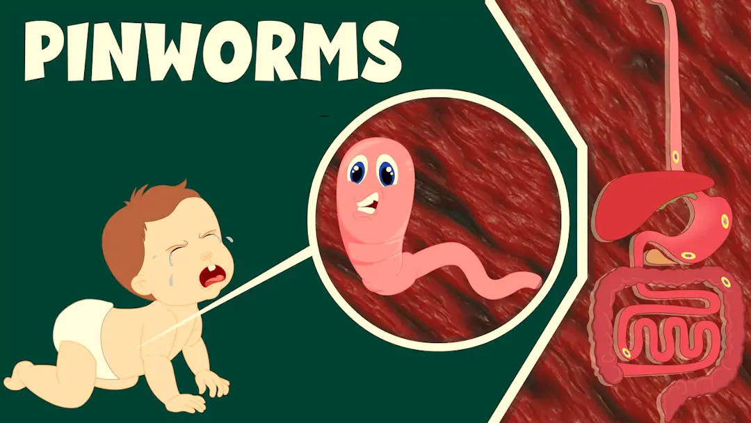pinworm-in-baby