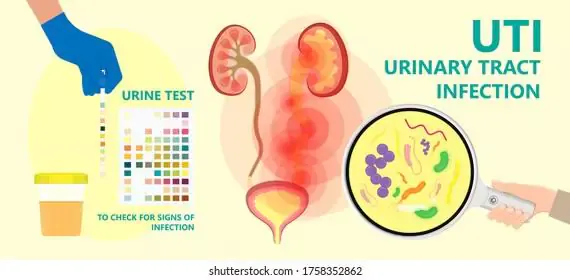 urinary-tract-infections-uti-in-kids